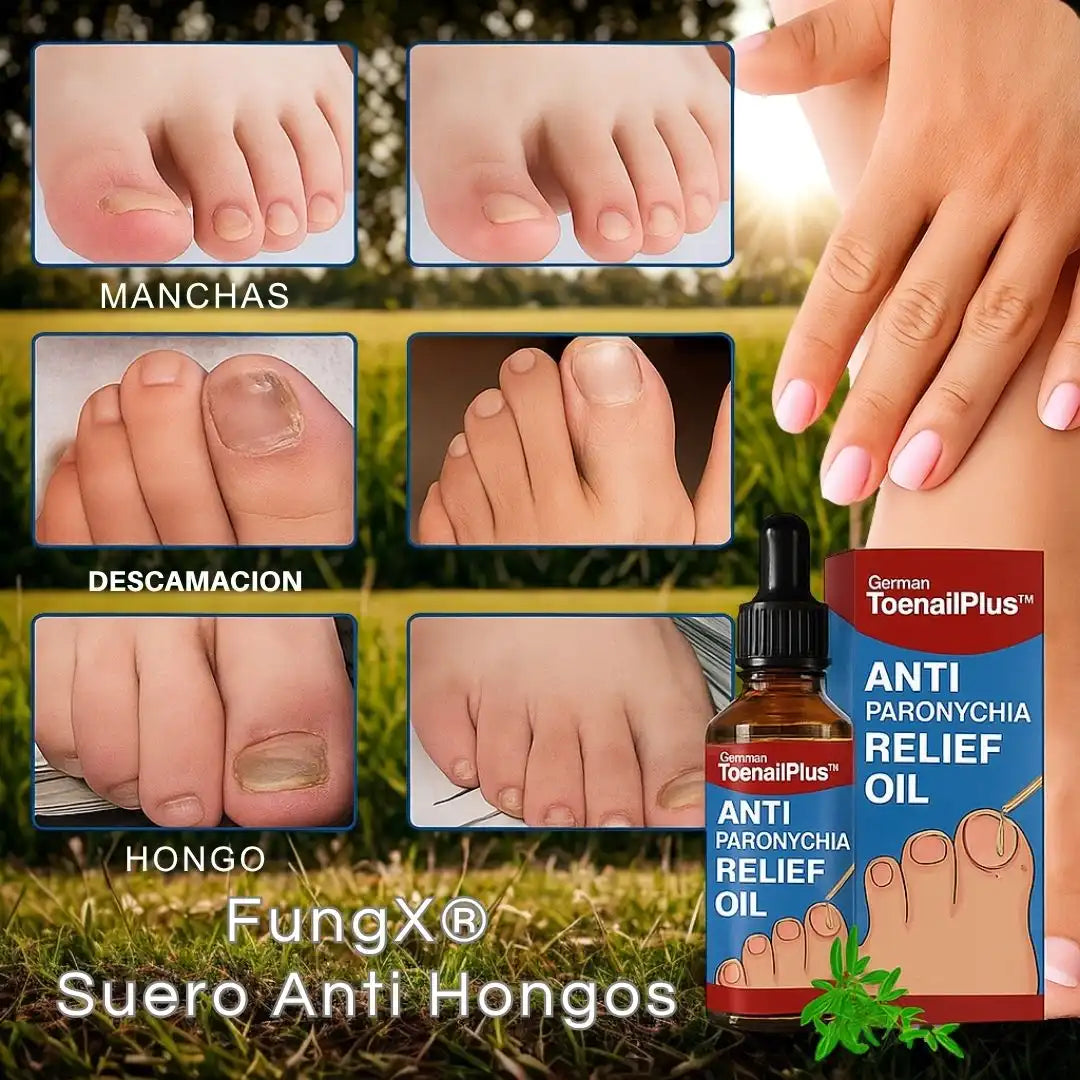 FungX® – Suero Anti Hongos Di adiós al dolor de uñas encarnadas y hongos ¡sin salir de casa!