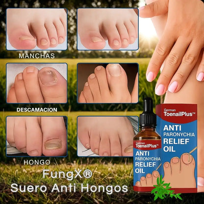 FungX® – Suero Anti Hongos Di adiós al dolor de uñas encarnadas y hongos ¡sin salir de casa!