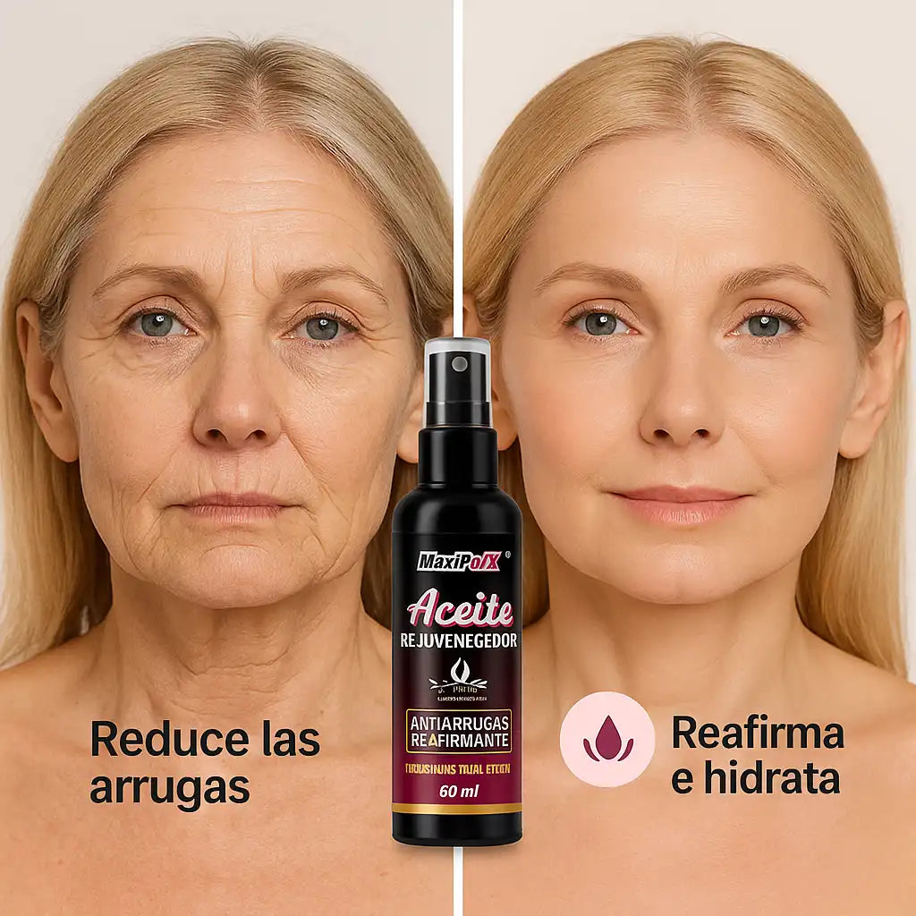 MaxiPlux® | Aceite Antiarrugas Rejuvenecedor – Piel firme, joven e hidratada al instante
